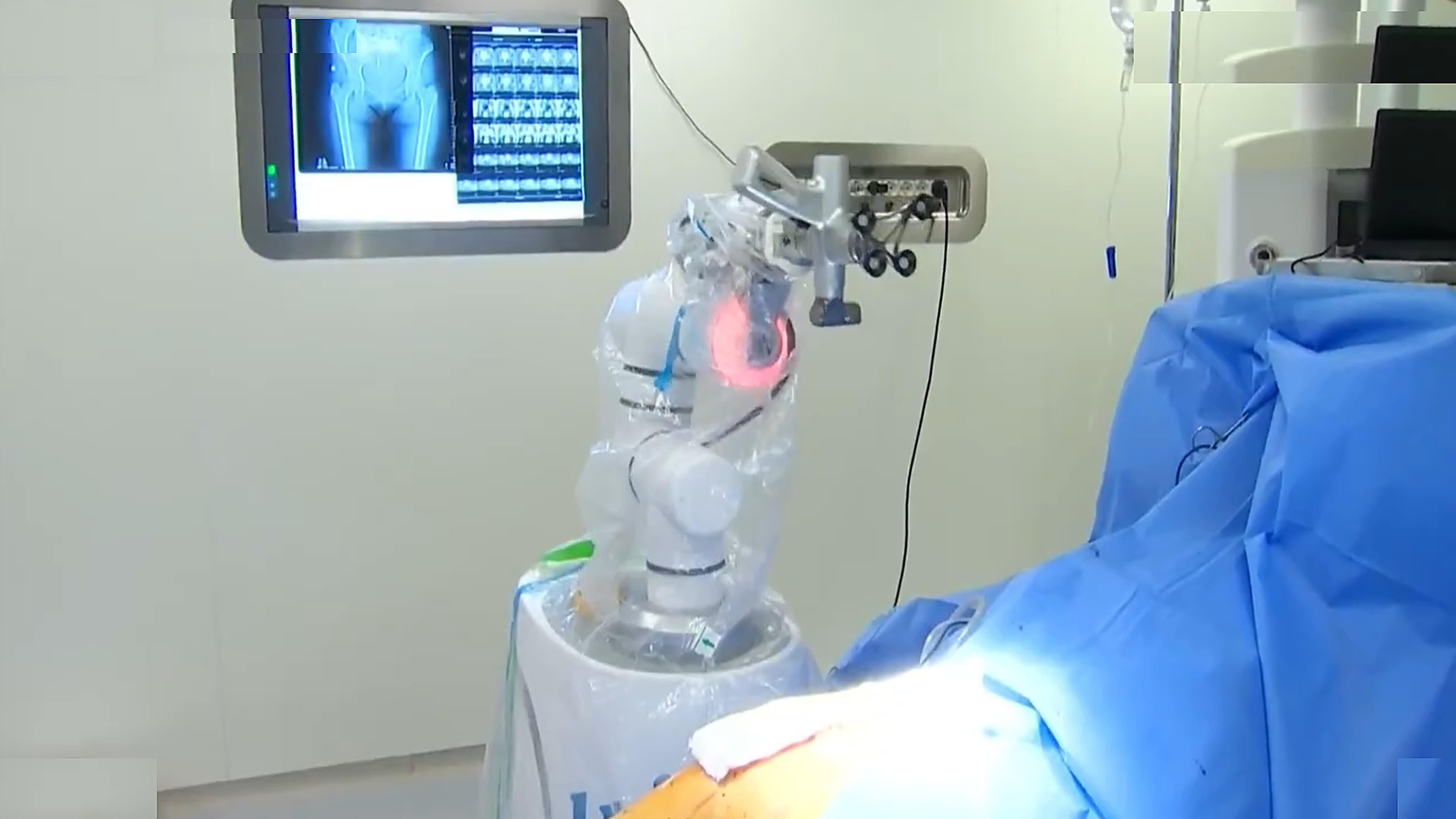 O’zbekistonda jarrohlik operatsiyasi robot yordamida amalga oshirildi
